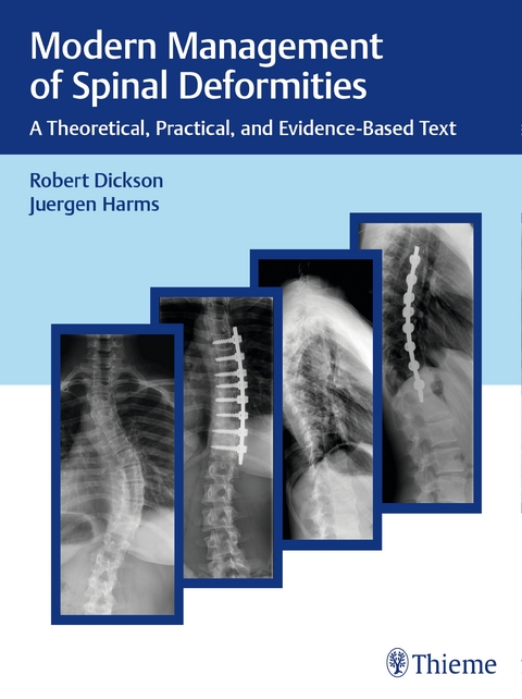 Modern Management of Spinal Deformities - Robert A. Dickson, Jürgen Harms