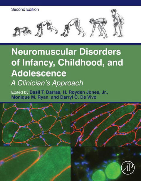 Neuromuscular Disorders of Infancy, Childhood, and Adolescence - 