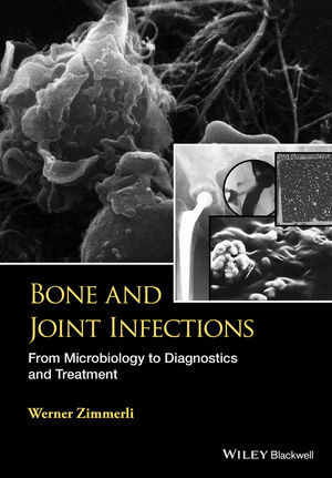 Bone and Joint Infections -  W. Zimmerli