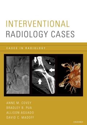 Interventional Radiology Cases - 