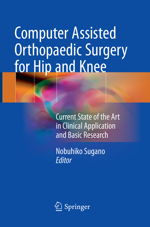 Computer Assisted Orthopaedic Surgery for Hip and Knee - 