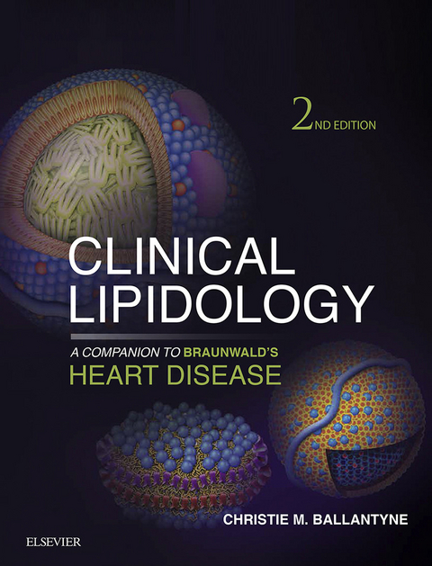 Clinical Lipidology: A Companion to Braunwald's Heart Disease -  Christie M. Ballantyne