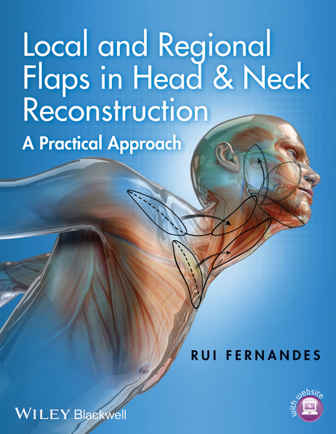 Local and Regional Flaps in Head and Neck Reconstruction -  Rui Fernandes