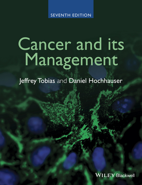 Cancer and its Management -  Daniel Hochhauser,  Jeffrey S. Tobias