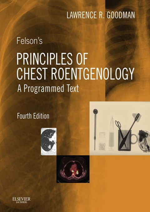 Felson's Principles of Chest Roentgenology E-Book -  Lawrence R. Goodman