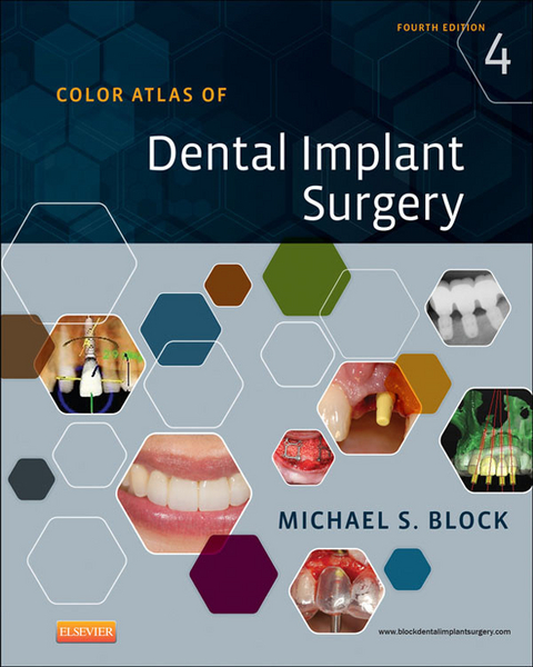 Color Atlas of Dental Implant Surgery - E-Book -  Michael S. Block