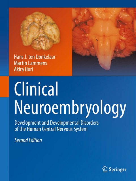 Clinical Neuroembryology -  Hans J. ten Donkelaar,  Martin Lammens,  Akira Hori