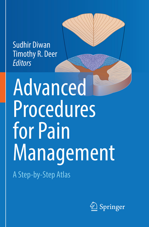 Advanced Procedures for Pain Management - 
