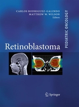 Retinoblastoma - 