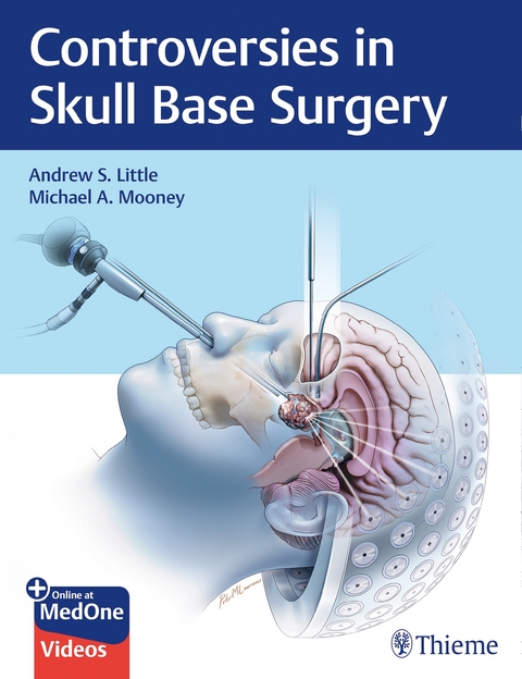 Controversies in Skull Base Surgery - Andrew Little, Michael Mooney