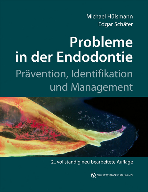 Probleme in der Endodontie - Michael Hülsmann, Edgar Schäfer