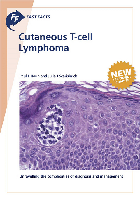Fast Facts: Cutaneous T-cell Lymphoma - Paul L. Haun, Julia J. Scarisbrick