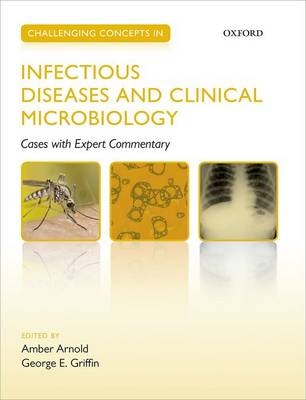 Challenging Concepts in Infectious Diseases and Clinical Microbiology - 