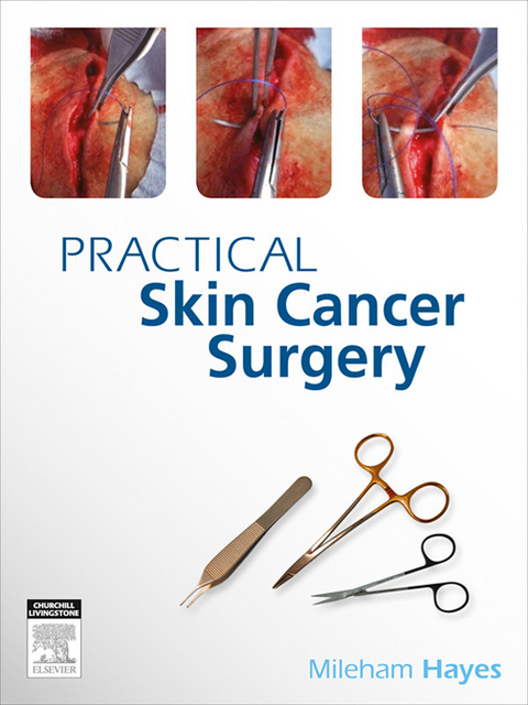 Practical Skin Cancer Surgery -  MILEHAM HAYES