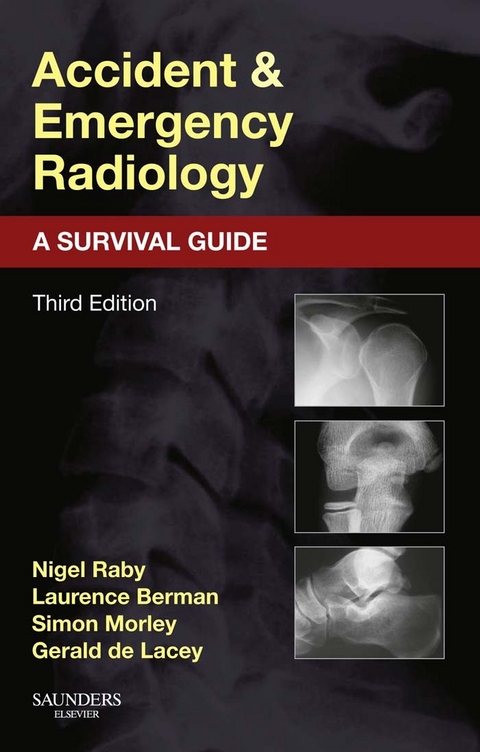 Accident and Emergency Radiology: A Survival Guide -  Laurence BERMAN,  Gerald de Lacey,  Simon MORLEY,  Nigel Raby