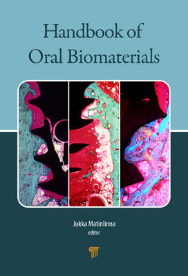 Handbook of Oral Biomaterials - 