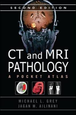CT & MRI Pathology: A Pocket Atlas, Second Edition -  Jagan Mohan Ailinani,  Michael L. Grey