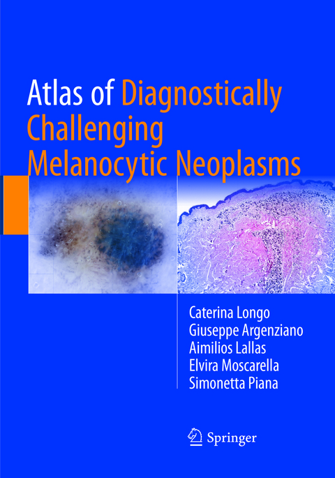 Atlas of Diagnostically Challenging Melanocytic Neoplasms - Caterina Longo, Giuseppe Argenziano, Aimilios Lallas, Elvira Moscarella, Simonetta Piana