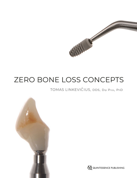 Zero Bone Loss Concepts - Tomas Linkevicius