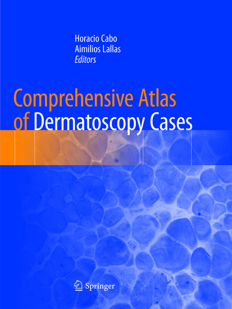 Comprehensive Atlas of Dermatoscopy Cases - 
