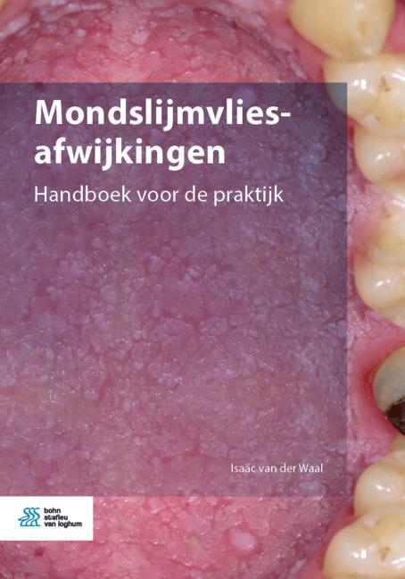 Mondslijmvliesafwijkingen - Isa�c Van Der Waal