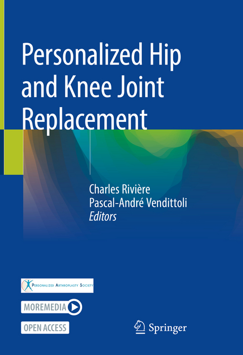 Personalized Hip and Knee Joint Replacement - 