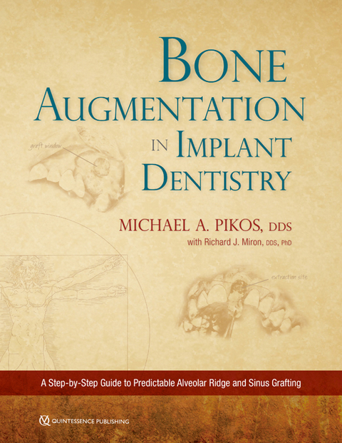 Bone Augmentation in Implant Dentistry - Michael A Pikos