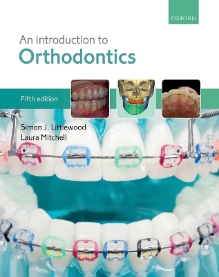 An Introduction to Orthodontics - Simon J. Littlewood, Laura Mitchell