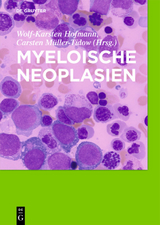 Myeloische Neoplasien - 