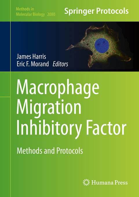 Macrophage Migration Inhibitory Factor - 