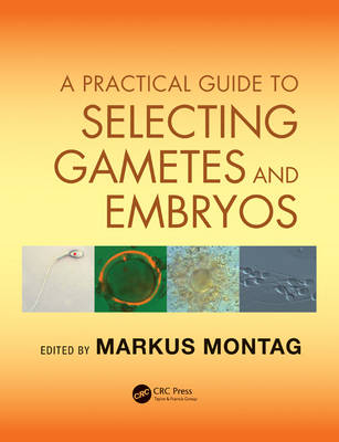 A Practical Guide to Selecting Gametes and Embryos - 