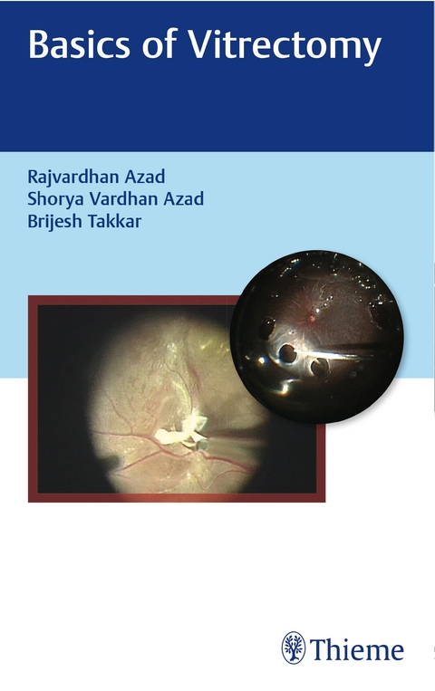 Basics of Vitrectomy - Rajvardhan Azad, Shorya Vardhan, Brijesh Takkar