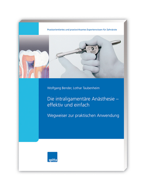 Die intraligamentäre Anästhesie – effektiv und einfach - Wolfgang Bender, Lothar Taubenheim