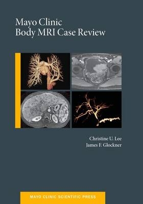 Mayo Clinic Body MRI Case Review -  James Glockner,  Christine U.C. Lee