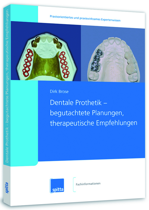 Dentale Prothetik – begutachtete Planungen, therapeutische Empfehlungen - Dirk Brose