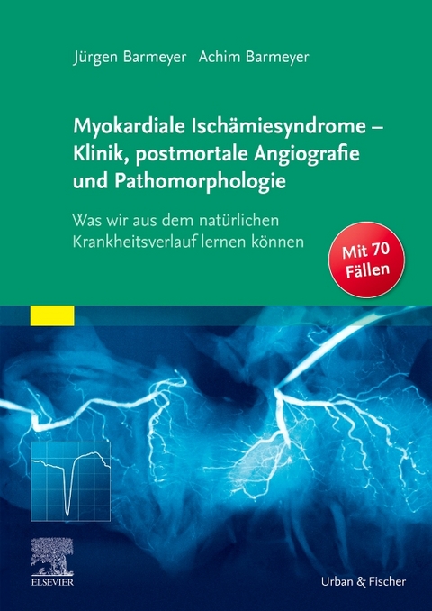 Myokardiale Ischämiesyndrome - Klinik, postmortale Angiografie und Pathomorphologie - Jürgen Barmeyer, Achim Barmeyer