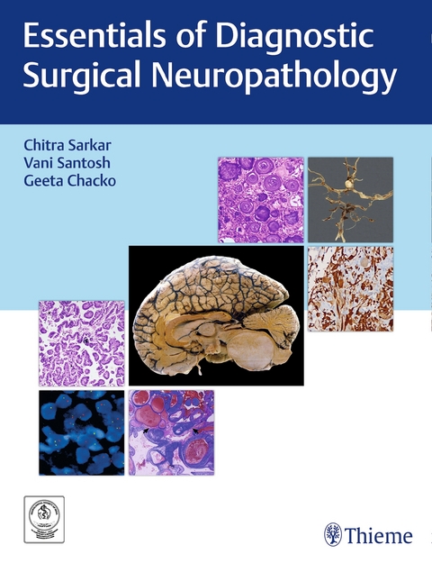 Essentials of Diagnostic Surgical Neuropathology - 