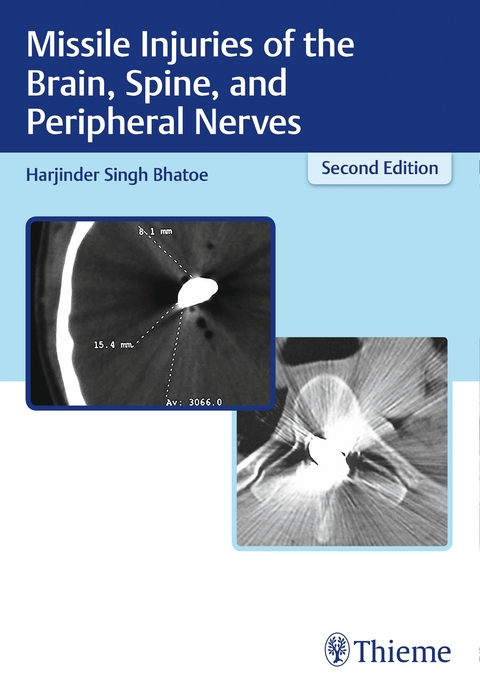 Missile Injuries of the Brain, Spine, and Peripheral Nerves - Harjinder S. Bhatoe