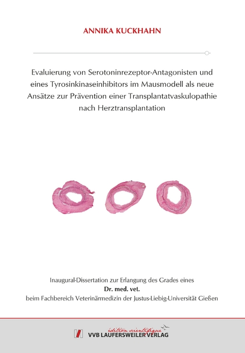 Evaluierung von Serotoninrezeptor-Antagonisten und eines Tyrosinkinaseinhibitors im Mausmodell als neue Ansätze zur Prävention einer Transplantatvaskulopathie nach Herztransplantation - Annika Kuckhahn