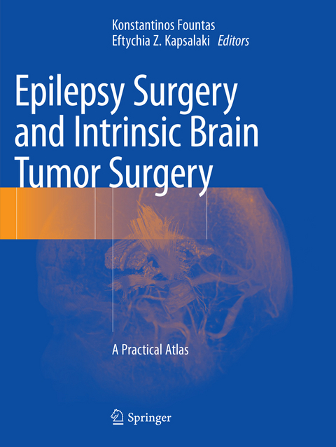 Epilepsy Surgery and Intrinsic Brain Tumor Surgery - 