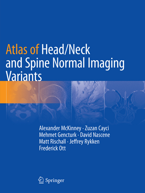 Atlas of Head/Neck and Spine Normal Imaging Variants - Alexander McKinney, Zuzan Cayci, Mehmet Gencturk, David Nascene, Matt Rischall, Jeffrey Rykken, Frederick Ott