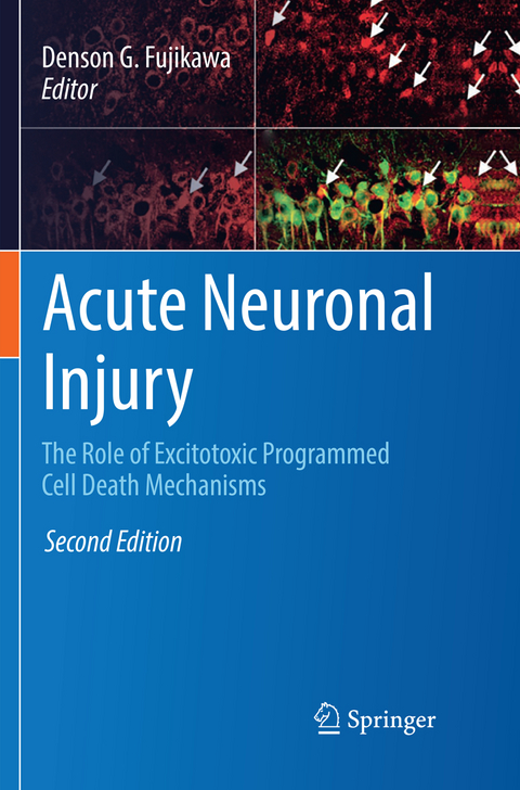 Acute Neuronal Injury - 