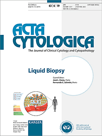 Liquid Biopsy - 
