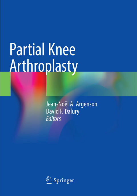 Partial Knee Arthroplasty - 