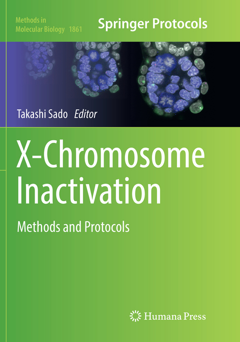 X-Chromosome Inactivation - 