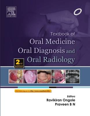 Textbook of Oral Medicine, Oral Diagnosis and Oral Radiology - E-Book - 