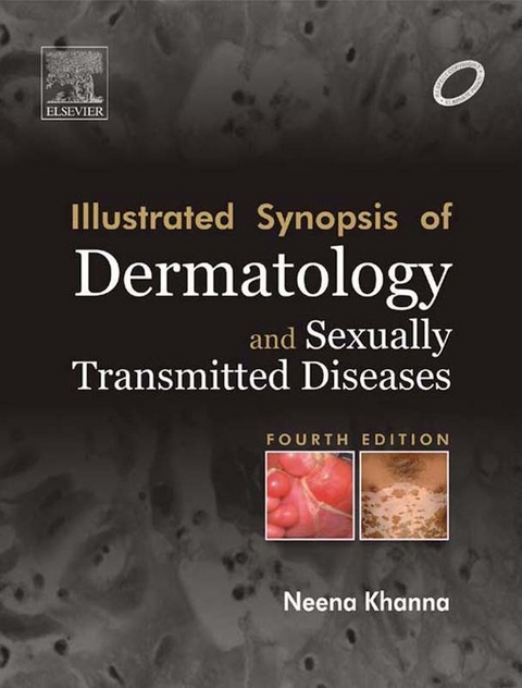 Illustrated Synopsis of Dermatology & Sexually Transmitted Diseases - E-book -  Neena Khanna