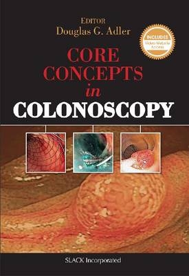 Core Concepts in Colonoscopy - 