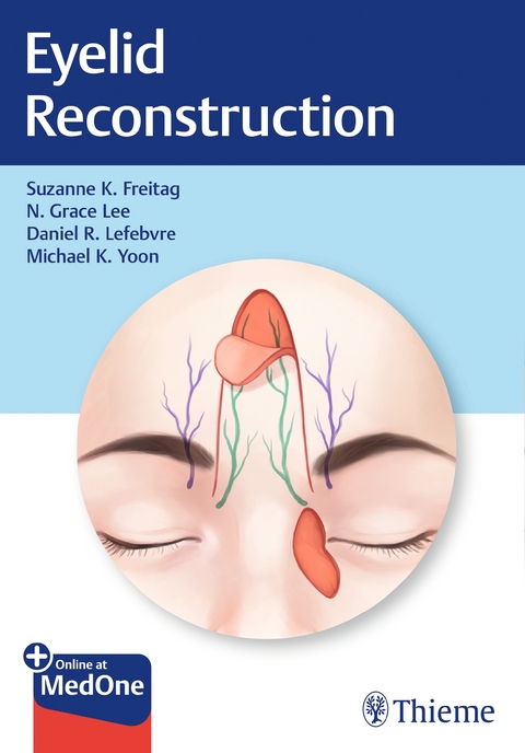 Eyelid Reconstruction - Suzanne Freitag, Nahyoung Grace Lee, Daniel Lefebvre, Michael Yoon