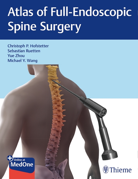 Atlas of Full-Endoscopic Spine Surgery - Christoph Hofstetter, Sebastian Ruetten, Yue Zhou, Michael Wang